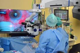chirurgie bariatrique