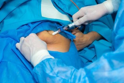 chirurgie bariatrique