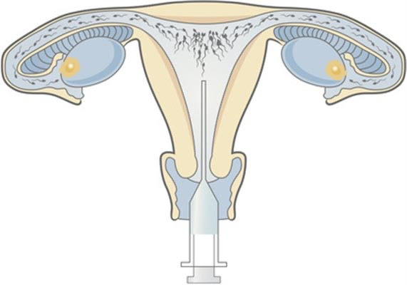 chirurgie bariatrique
