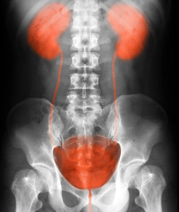 chirurgie bariatrique
