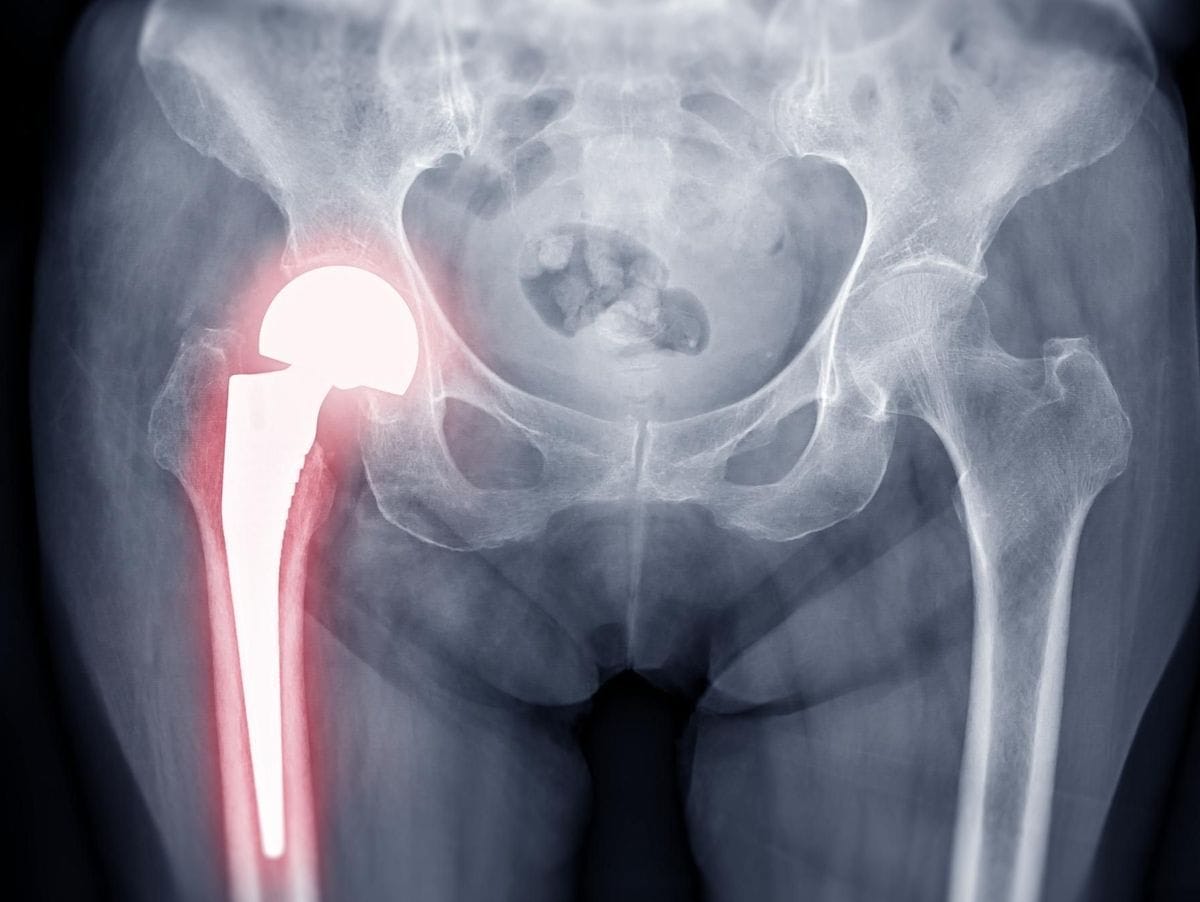 Orthopédie Et Traumatologie 2