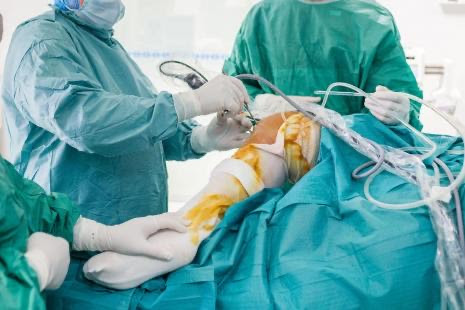 chirurgie bariatrique